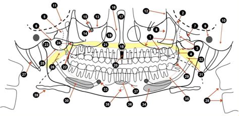 OPG anatomy 2 Diagram | Quizlet