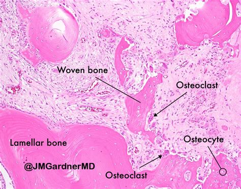 Bone Remodeling Histology