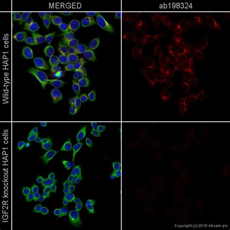 Alexa Fluor® 647 Anti-M6PR (cation independent) antibody [EPR6599] (ab198324)