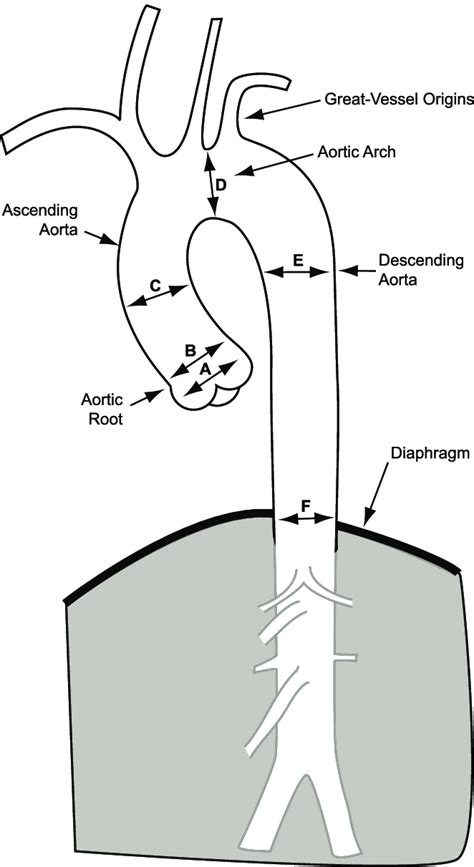 This diagram of the thoracic aorta demonstrates the segments used for... | Download Scientific ...