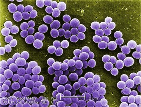 Staphylococcus | Concise Medical Knowledge