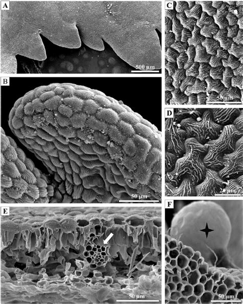 Portions of the adaxial surface (A-D, F) and the cross section (E) of ...