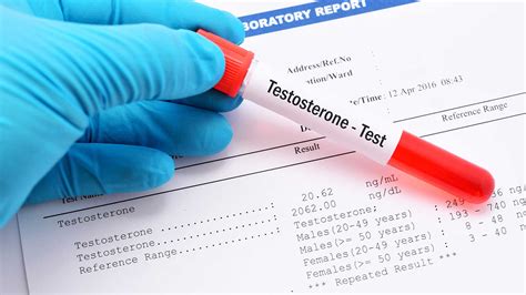 Do Boron Supplements Increase Testosterone? | Borates Today