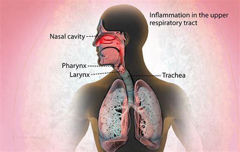 Health Condition : Symptoms, Causes, Treatment and More