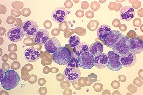 Lab Chronicles: My Experience in the Hematology Laboratory | My Kind of Science