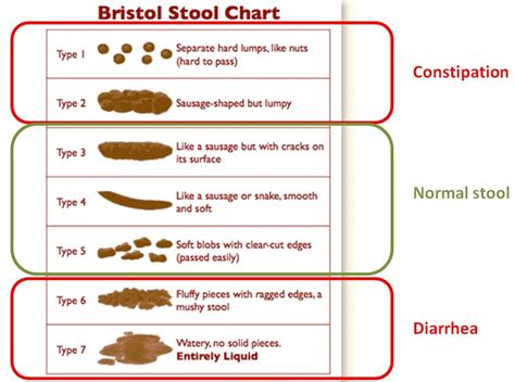 What are the symptoms of IBS? - IBS Fact IBS Fact