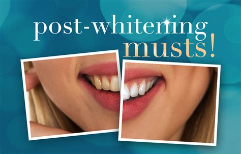 The Time Right After Your Tooth-Whitening Treatment is Critical | Our ...