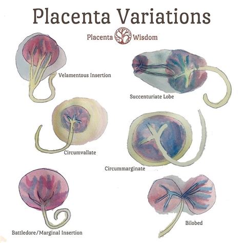 Placenta watercolours. | Student midwife, Midwifery, Midwifery student