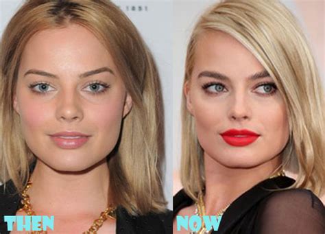 Margot Robbie Plastic Surgery Before and After Pictures - Lovely ...