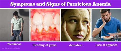 How To Diagnose Pernicious Anemia - Riseband2