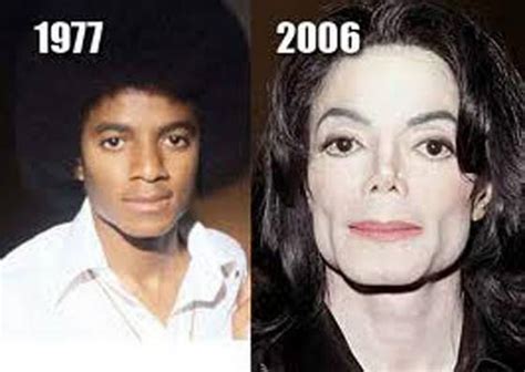 Michael Jackson Plastic Surgery Before and After Nose Jobs and Skin tone - Celebrity Plastic Surgery