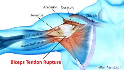 10 Common Causes of Shoulder Pain and Ways to Treat Them