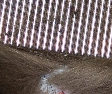 Understanding Cat Lice: Symptoms, Treatment, and Prevention - Tcrascolorado