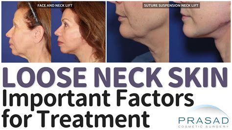 How to Tighten Neck Skin? Surgical and Non-Surgical Options