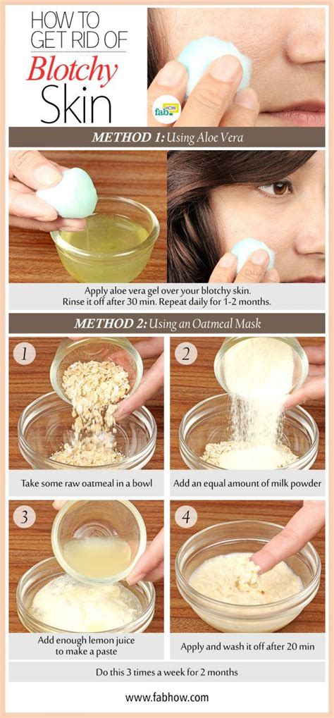 How to Get Rid of Blotchy Skin with Natural Home Remedies | Fab How