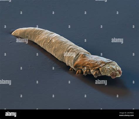 Demodex Eyelash Mites