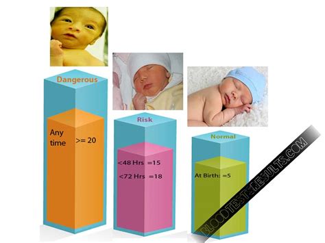 Updated: Jaundice Levels Chart in Newborns (Jaundice Levels 5,12,15,18,20,30 explained) – Blood ...