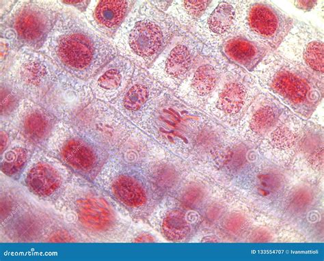 Metaphase of an Onion Root Tip Cell Under the Microscope Stock Image - Image of meiosis ...