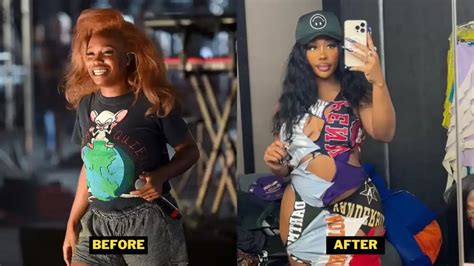 SZA Plastic Surgery. BBL, Before And After Pictures.