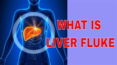 👍👍LIVER FLUKES IN HUMANS | Liver flukes, Liver fluke, What is living