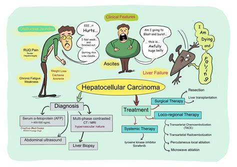 Hepatocellular Carcinoma (HCC) - Creative Med Doses