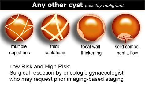 Ovarian Cyst Size Chart