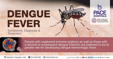 Dengue Fever - Symptoms, Causes, Diagnosis and Treatment