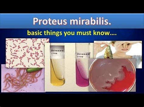Proteus Mirabilis Microbiology Proteus Mirabilis Food - vrogue.co