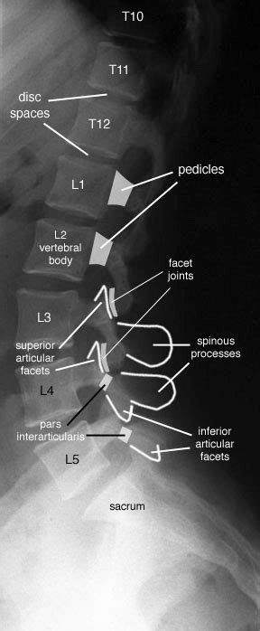 Lumbar Vertebrae Anatomy Lateral 15840 | Hot Sex Picture