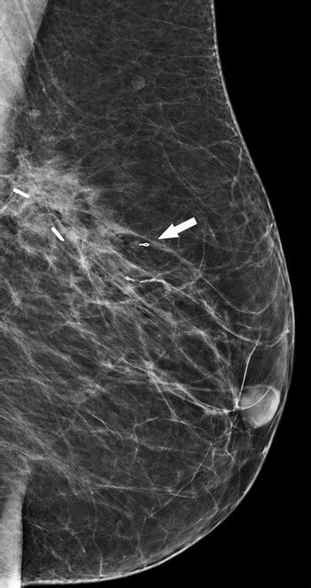 Developing Asymmetry | Radiology Key