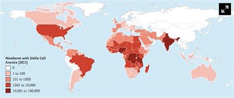 Frontiers | Life-Threatening Infectious Complications in Sickle Cell ...