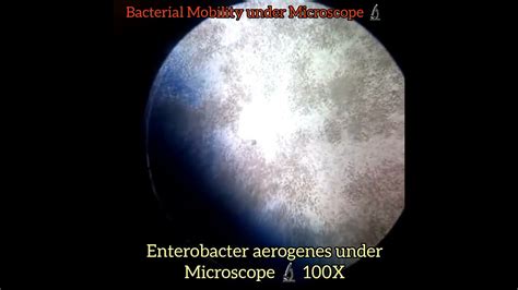 Enterobacter aerogenes under Microscope 🔬100X/450/10000X| Bacteria | Klebsiella aerogenes ...