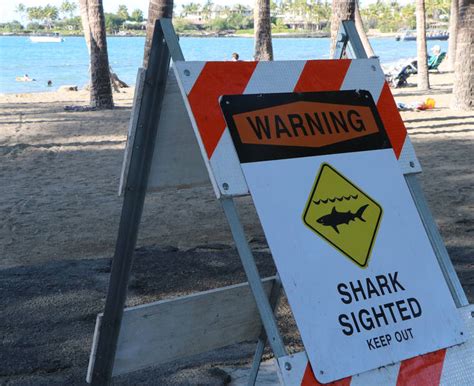 Waikoloa man hospitalized after apparent shark attack - West Hawaii Today