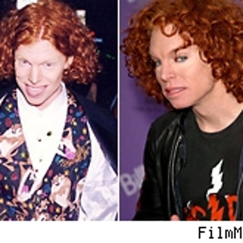 Carrot Top Before And After Body