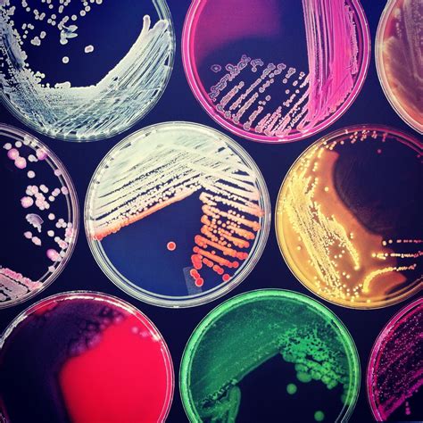 Microbial Growth Plates at Leona Shively blog