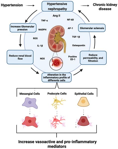 IJMS | Free Full-Text | Hypertensive Nephropathy: Unveiling the ...