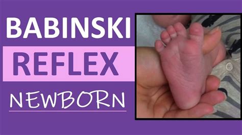 Babinski Reflex Assessment in Newborn Infant | Pediatric Nursing ...