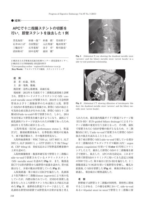 (PDF) A successful biliary stent removal after trimming the duodenal metallic stent using argon ...