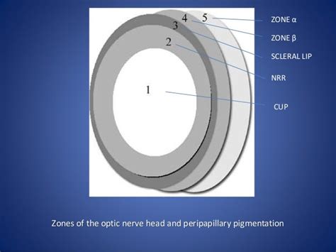 Optic disc evaluation