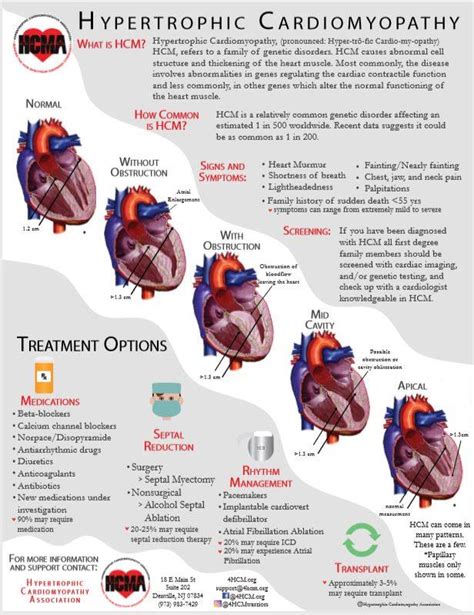 Obstruction - Hypertrophic Cardiomyopathy Association