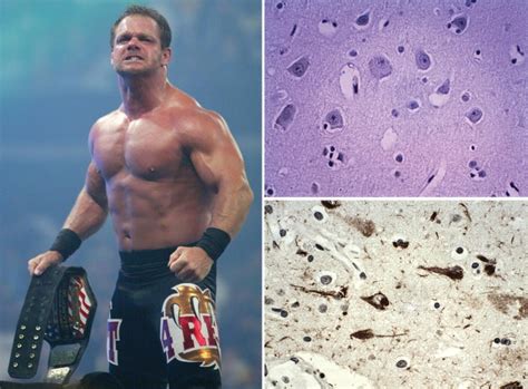 Chris Benoit Autopsy Photos