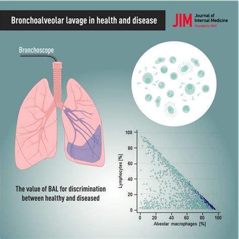 The value of bronchoalveolar lavage for discrimination between healthy and diseased individuals ...