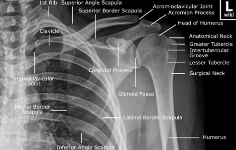 AP of the shoulder Radiology Schools, Radiology Student, Radiology Imaging, Medical Imaging ...