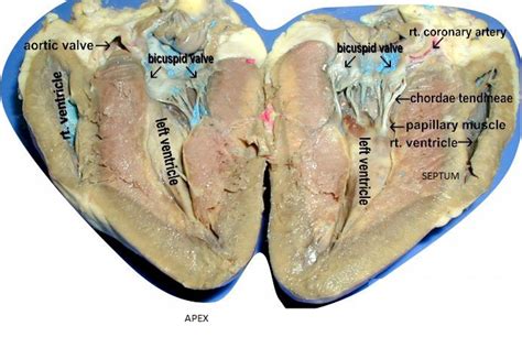 4.1.2 Heart Dissection