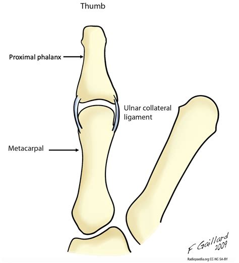 Collateral Ligament Hand