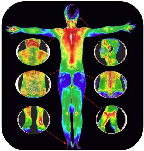 Full Body Scan - Thermal Imaging Texas - Angel Marlow - Houston, TX - Thermography - Thermal ...