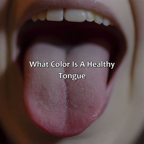 What Color Is A Healthy Tongue - colorscombo.com