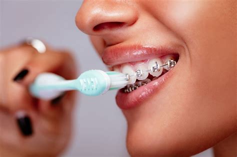 How to Brush Teeth With Braces | Greater Hartford Orthodontics