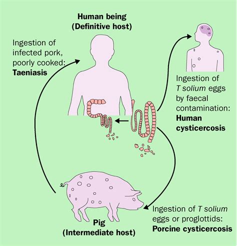 Taenia solium cysticercosis - The Lancet