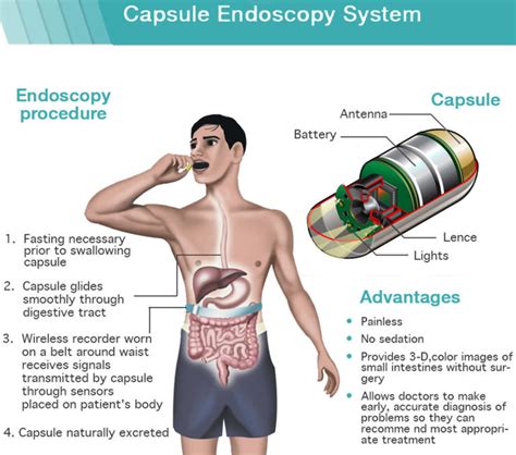 Endoscopy - Prep, Risks and Endoscopy Procedure